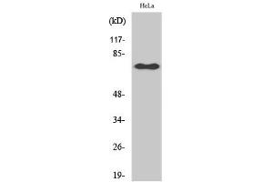 Western Blotting (WB) image for anti-Nuclear Factor-kB p65 (NFkBP65) (pSer529) antibody (ABIN5961223) (NF-kB p65 anticorps  (pSer529))