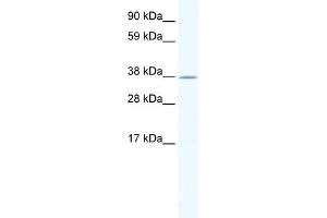 WB Suggested Anti-NKX2-3 Antibody Titration:  1. (NK2 Homeobox 3 anticorps  (Middle Region))