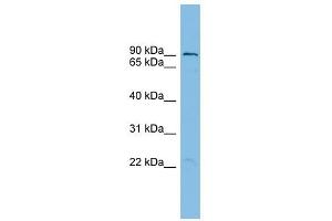 TBC1D16 antibody used at 1 ug/ml to detect target protein. (TBC1D16 anticorps  (N-Term))