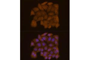 Immunofluorescence analysis of HeLa cells using Galectin 3/LG Rabbit mAb (ABIN7267337) at dilution of 1:50 (40x lens). (Galectin 3 anticorps)