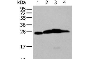 Western blot analysis of Mouse brain tissue Rat brain tissue Human cerebrum tissue Human cerebella tissue lysates using MOG Polyclonal Antibody at dilution of 1:250 (MOG anticorps)