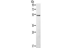 Western Blotting (WB) image for anti-serine/threonine/tyrosine Kinase 1 (STYK1) antibody (ABIN2427349) (STYK1 anticorps)