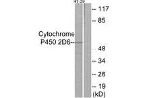 Western blot analysis of extracts from HT-29 cells, using Cytochrome P450 2D6 Antibody. (CYP2D6 anticorps  (AA 251-300))