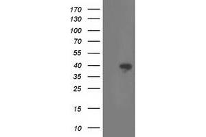 HEK293T cells were transfected with the pCMV6-ENTRY control (Left lane) or pCMV6-ENTRY RLBP1 (Right lane) cDNA for 48 hrs and lysed. (RLBP1 anticorps)