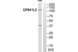 Western Blotting (WB) image for anti-erythrocyte Membrane Protein Band 4.1-Like 2 (EPB41L2) (Internal Region) antibody (ABIN1850881) (EPB41L2 anticorps  (Internal Region))