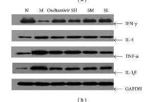 Western Blotting (WB) image for anti-Interferon gamma (IFNG) (AA 75-155) antibody (ABIN669126)