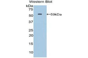 Western Blotting (WB) image for anti-Moesin (MSN) (AA 354-577) antibody (ABIN1859888) (Moesin anticorps  (AA 354-577))