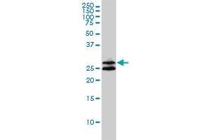 Western Blotting (WB) image for anti-Ankyrin Repeat and SOCS Box Containing 9 (ASB9) (AA 1-252) antibody (ABIN566832)