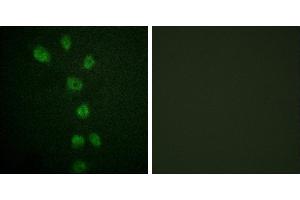 P-peptide - +Immunofluorescence analysis of HepG2 cells, using GATA4 (Phospho-Ser105) antibody. (GATA4 anticorps  (pSer105))