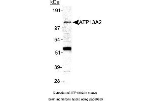 Image no. 2 for anti-ATPase Type 13A2 (ATP13A2) (AA 200-300), (Internal Region) antibody (ABIN363562) (ATP13A2 anticorps  (Internal Region))