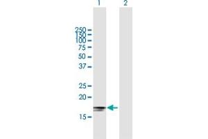 Western Blot analysis of IFNA2 expression in transfected 293T cell line by IFNA2 MaxPab polyclonal antibody. (IFNA2 anticorps  (AA 1-188))