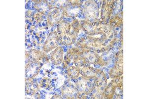 Immunohistochemistry of paraffin-embedded rat kidney using EHHADH antibody at dilution of 1:100 (40x lens). (EHHADH anticorps)