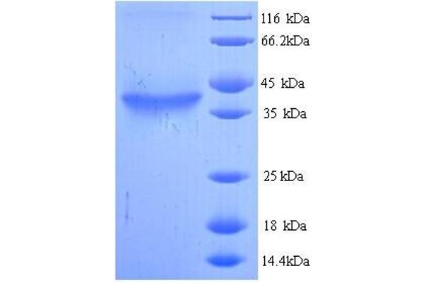 HAS2 Protein (AA 67-374, Cytoplasmic Domain, Cytosolic) (His tag)