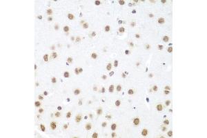 Immunohistochemistry of paraffin-embedded mouse brain using DDX39B antibody (ABIN5974669) at dilution of 1/100 (40x lens). (DDX39B anticorps)