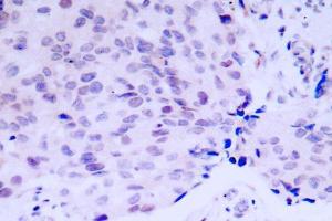 Image no. 2 for anti-Retinoblastoma 1 (RB1) antibody (ABIN271803) (Retinoblastoma 1 anticorps)