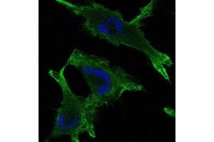 Immunofluorescence analysis of U251 cells using JUP mouse mAb (green). (JUP anticorps)