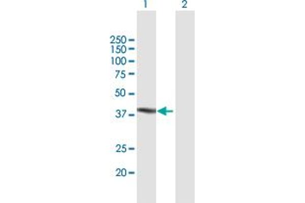 TUBD1 anticorps  (AA 1-398)