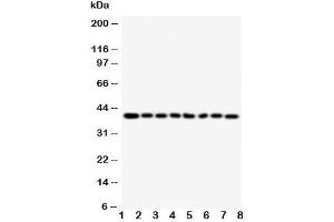 Western blot testing of PPID antibody and Lane 1:  rat brain (PPID anticorps  (AA 351-370))