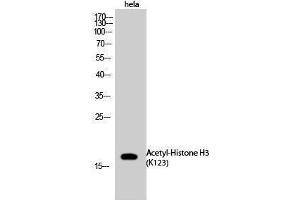 Western Blotting (WB) image for anti-Histone 3 (H3) (acLys123) antibody (ABIN3188007) (Histone 3 anticorps  (acLys123))
