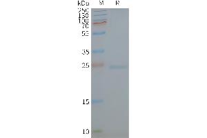 Human -Nanodisc, Flag Tag on SDS-PAGE (Caveolin-1 Protéine)