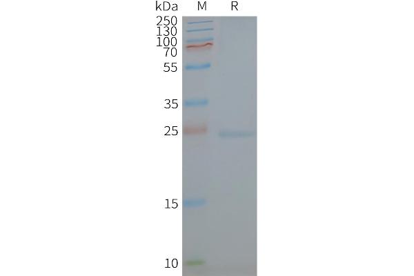 Caveolin-1 Protéine