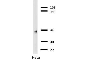 Western blotting analysis of cytokeratin 18 in HeLa cells with anti-cytokeratin 18 biotin. (Cytokeratin 18 anticorps  (Biotin))