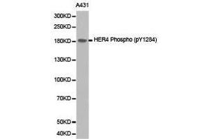 Western Blotting (WB) image for anti-V-Erb-A erythroblastic Leukemia Viral Oncogene Homolog 4 (Avian) (ERBB4) (pTyr1284) antibody (ABIN1870170) (ERBB4 anticorps  (pTyr1284))