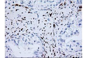 Image no. 1 for anti-NudE Nuclear Distribution E Homolog (A. Nidulans)-Like 1 (NDEL1) antibody (ABIN1499853) (NDEL1 anticorps)