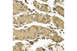 Immunohistochemistry of paraffin-embedded human stomach using SETD5 antibody (ABIN5974406) at dilution of 1/100 (40x lens). (SETD5 anticorps)