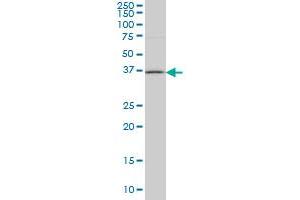 Western Blotting (WB) image for anti-Hydroxysteroid (17-Beta) Dehydrogenase 1 (HSD17B1) (AA 189-286) antibody (ABIN598750) (HSD17B1 anticorps  (AA 189-286))