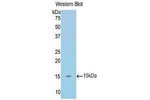 Western Blotting (WB) image for anti-Interleukin 1 Receptor, Type I (IL1R1) (AA 119-217) antibody (ABIN1172134) (IL1R1 anticorps  (AA 119-217))