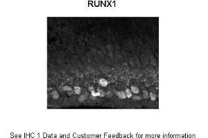Sample Type : Mouse, post-natal day (p) 0 retinal ganglion cells Primary Antibody Dilution : 1:1500 Secondary Antibody : Donkey anti rabbit IgG Alexa 594 Secondary Antibody Dilution : 1:1000 Gene Name : RUNX1  Submitted by : Anonymous (RUNX1 anticorps  (Middle Region))