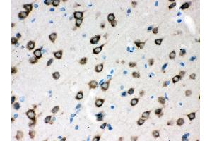 Anti- SMN1/2 Picoband antibody,IHC(P) IHC(P): Rat Brain Tissue (SMN1 / SMN2 (AA 22-52), (N-Term) anticorps)