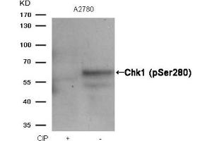 Western blot analysis of extracts from A2780 cells, treated with calf intestinal phosphatase (CIP), using Chk1 (Phospho-Ser280) Antibody. (CHEK1 anticorps  (pSer280))