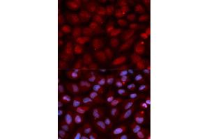 Immunofluorescence (IF) image for anti-CD47 (CD47) (AA 20-140) antibody (ABIN3022624) (CD47 anticorps  (AA 20-140))