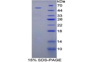 SDS-PAGE (SDS) image for Angiopoietin-Like 3 (ANGPTL3) ELISA Kit (ABIN6730980)