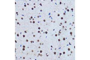 Immunohistochemistry of paraffin-embedded rat brain using TDP-43/TARDB Rabbit pAb  at dilution of 1:500 (40x lens). (TARDBP anticorps  (AA 1-100))