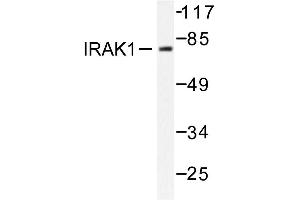 Image no. 1 for anti-Interleukin-1 Receptor-Associated Kinase 1 (IRAK1) antibody (ABIN272026) (IRAK1 anticorps)