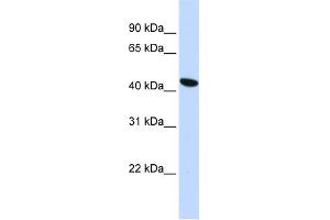 WB Suggested Anti-TMEM117 Antibody Titration:  0. (TMEM117 anticorps  (Middle Region))