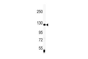 Western blot analysis of anti-Vinculin Antibody (C-term) (ABIN391626 and ABIN2841546) in mouse lung tissue lysates (35 μg/lane). (Vinculin anticorps  (C-Term))