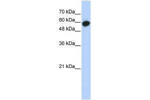 WB Suggested Anti-LRRC6 Antibody Titration: 0. (LRRC6 anticorps  (Middle Region))