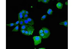 Immunofluorescent analysis of HepG2 cells using ABIN7156663 at dilution of 1:100 and Alexa Fluor 488-congugated AffiniPure Goat Anti-Rabbit IgG(H+L) (IFIT1 anticorps  (AA 1-181))