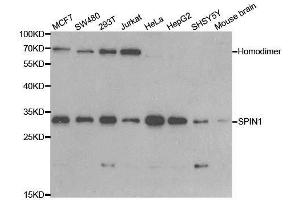 Western blot analysis of extracts of various cell lines, using SPIN1 antibody. (Spindlin 1 anticorps  (AA 1-262))