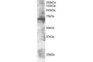 Western Blotting (WB) image for anti-SWAP Switching B-Cell Complex 70kDa Subunit (SWAP70) (C-Term) antibody (ABIN2466338) (SWAP70 anticorps  (C-Term))