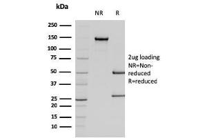 SDS-PAGE Analysis Purified Smooth Muscle Actin Mouse Monoclonal Antibody (SPM322). (Smooth Muscle Actin anticorps  (N-Term))