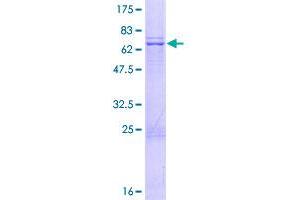 Image no. 1 for Mitochondrial Ribosomal Protein S35 (MRPS35) (AA 1-323) protein (GST tag) (ABIN1311382) (MRPS35 Protein (AA 1-323) (GST tag))