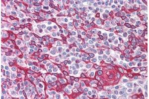 Human Thymus (formalin-fixed, paraffin-embedded) stained with TIMD4 antibody ABIN213994 at 5 ug/ml followed by biotinylated goat anti-rabbit IgG secondary antibody ABIN481713, alkaline phosphatase-streptavidin and chromogen. (TIMD4 anticorps  (Internal Region))