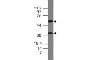 Image no. 1 for anti-Tumor Necrosis Factor (Ligand) Superfamily, Member 11 (TNFSF11) antibody (ABIN5027776) (RANKL anticorps)