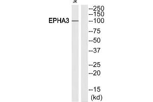Western blot analysis of extracts from Jurkat cells, using EPHA3 (epitope around residue 602) antibody. (EPH Receptor A3 anticorps)