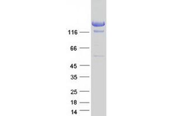 A2ML1 Protein (Myc-DYKDDDDK Tag)